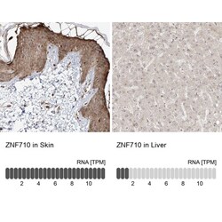 ZNF710 Antibody, Novus Biologicals:Antibodies:Primary Antibodies